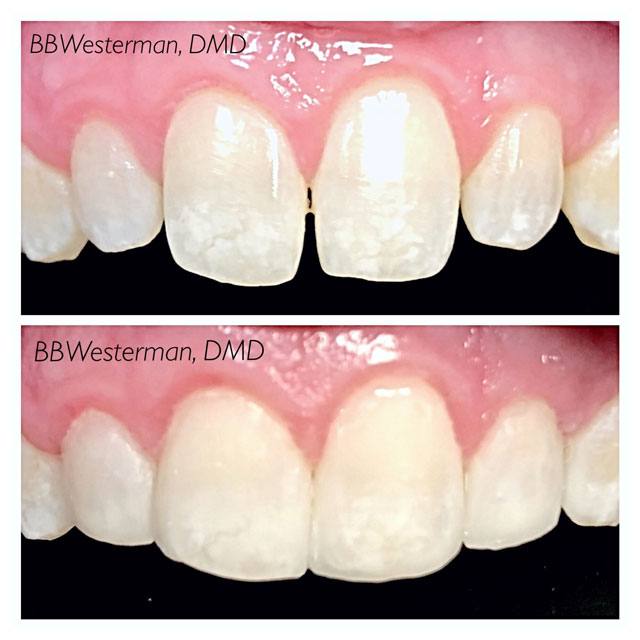 Smile Gallery Dentist Tuscumbia, AL Singing River Dentistry