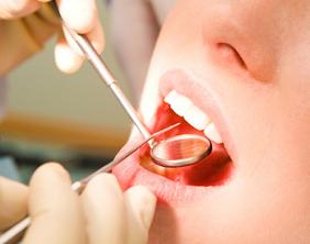 Signs That You Need To Improve Your Dental Care