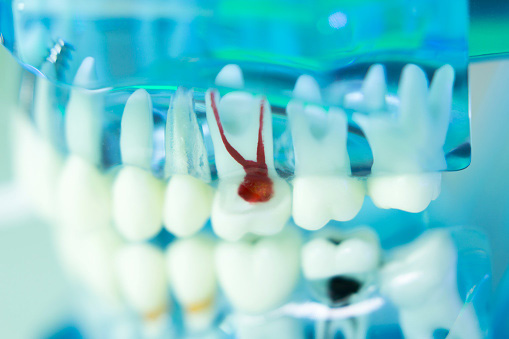 Educational model of human teeth